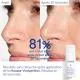 CAUDALIE Vinoperfect - Mousse Micro-Peeling Eclat 100ml - Illustration n°4